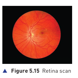 Textbook Figure 5.15 showing a retina scan